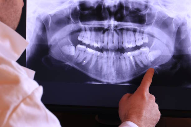 Best Emergency Root Canal Therapy in Exmore, VA