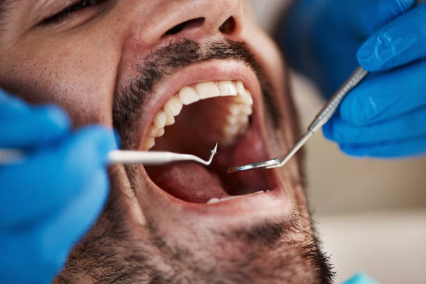Best Urgent Dental Care for Toothaches in Exmore, VA